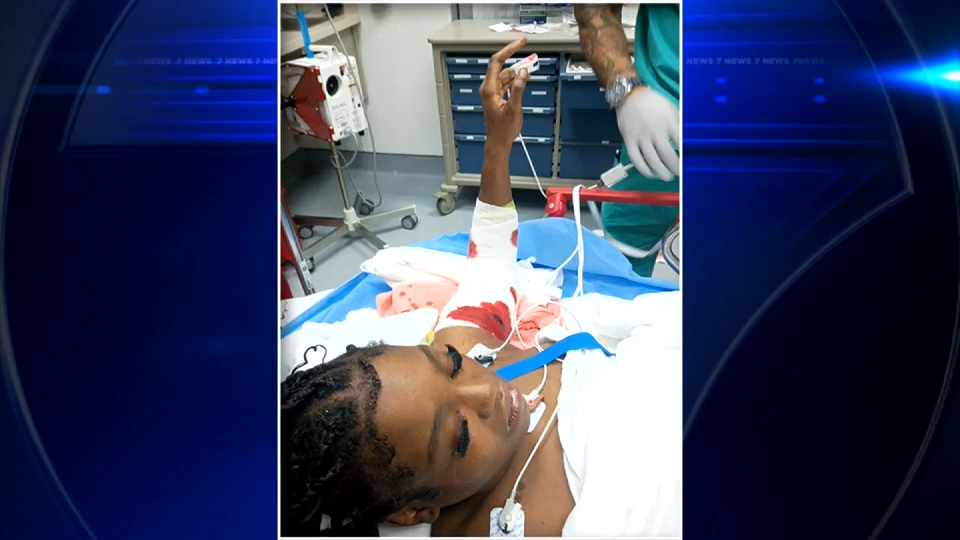 17-year-old speaks out while recovering from serious injuries in pit bull attack in NW Miami-Dade — WSVN 7 Miami-Dade, Coral Gables Health news